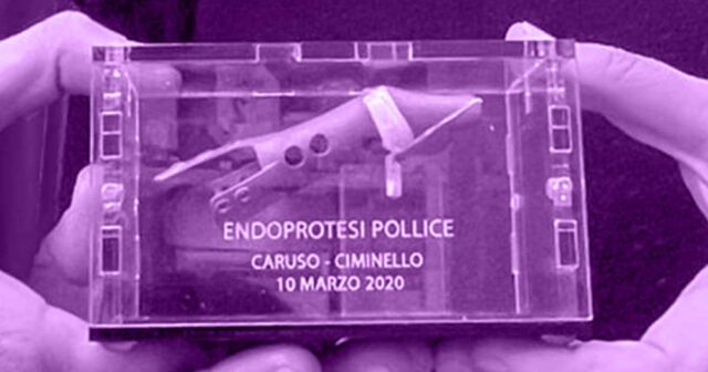 Endoprotesi pollice