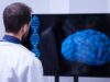 Test del sangue con IA per diagnosticare il Parkinson con 7 anni di anticipo Cervello Intelligenza artificiale parkinson