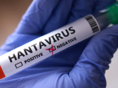 Hantavirus Andes sulla nave Hondius: origine, caratteristiche e rischi della variante più aggressiva Hantavirus