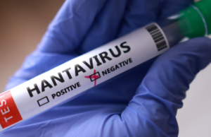 Hantavirus Andes sulla nave Hondius: origine, caratteristiche e rischi della variante più aggressiva Hantavirus